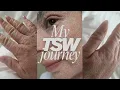 I moved across the world to heal my skin (My TSW Story)