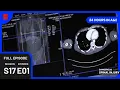 Download Lagu Motorbike Accident Emergency Treatment | 24 Hours in A\u0026E | Medical Documentary
