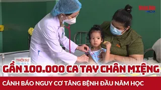 Gần 100.000 ca tay chân miệng, cảnh báo nguy cơ tăng bệnh đầu năm học | Tin tức SỨC KHỎE - ĐỜI SỐNG
