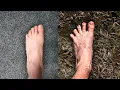I Wore Zero Drop BAREFOOT Shoes for 2 Years
