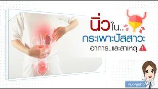 สาเหตุที่ทำให้เกิดนิ่วในกระเพาะปัสสาวะมีอะไรบ้าง