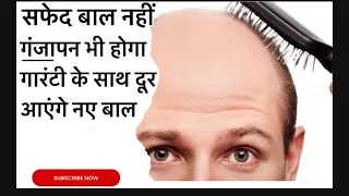 कैसे बनाये घर पर गंजापन सफेद बाल और डैंड्रफ के लिए तेल\ how to make hair oil at home