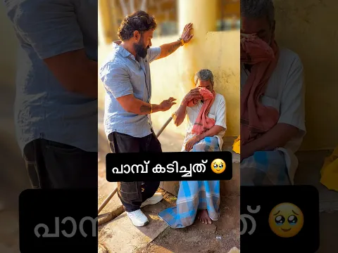 അണലി കടിച്ചാൽ കാൽ ഇങ്ങനെ ആകുമോ? #alfoodie #love # #lifeisbutadream #surprise