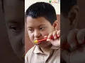 Treatment of Down Syndrome