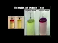 Microbiology Indole Test Tryptophanase