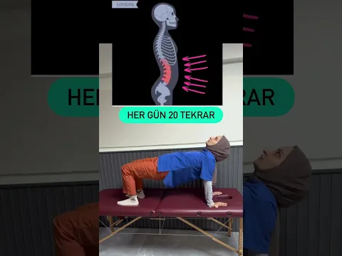 🌸 BEL ÇUKURU FAZLALIĞI tıbbi adıyla ARTMIŞ LORDOZ