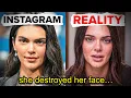 SAD TRUTH ABOUT KENDALL JENNER S FACE