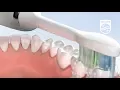 Download Lagu How to brush with Sonicare DiamondClean | Philips | Sonic electric toothbrush | HX9332