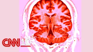 An alarming new study about professional football and head injuries | September 8, 2026