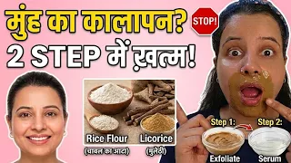 मुंह का कालापन? ❌ बस ये 2 Steps और जादू देखें! | Get Rid of Darkness Around Mouth