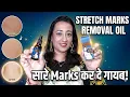 - Use Snail Oil For Removing Stretch Marks Scars Injury marks Wrinkles