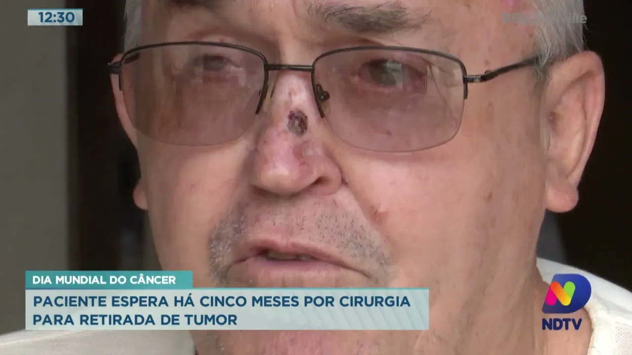 Dia mundial do câncer: Paciente espera há cinco meses por cirurgia para retirada de tumor