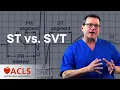 Download Lagu Differences Between ST (sinus tachycardia) and SVT | ACLS Certification Association
