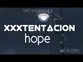 Download Lagu XXXTENTACION - hope (8D AUDIO)
