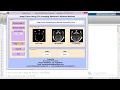 Matlab Code for Image Fusion Using PCA on MRI and CT Image