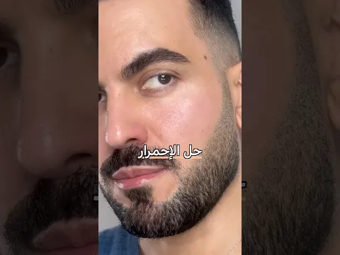 حل إحمرار البشرة 🧯🚒 #عناية_بالبشرة