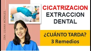 😱Me saqué una muela🤦‍♀️ cuánto tarda en cicatrizar? 3REMEDIOS NATURALES DE CICATRIZACIÓN/Episodio 62
