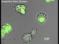 Macrophage Phagocytosis ROS microscopy live cell imaging Time lapse
