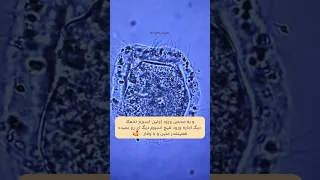 تخمک منتظر نمیمونه اونه که انتخاب میکنه 