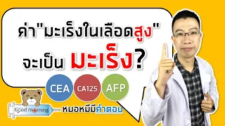 ควรตรวจคัดกรองมะเร็งลำไส้เมื่อไหร่ และวิธีไหนดีที่สุด?