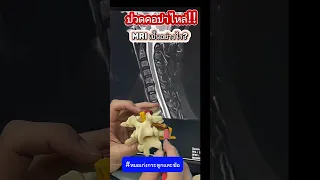  อาการชาและปวดร้าวลงแขนเกิดจากสาเหตุอะไร 