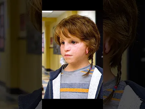 Everyone Avoided Him at School… Until One Boy Sat Beside Him 🫂