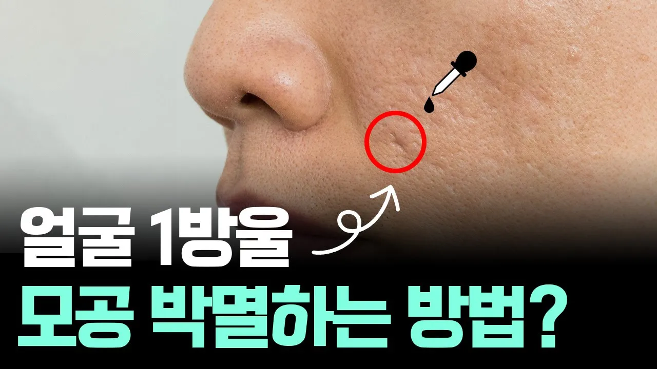 커진 모공 작게 만드는 방법, 피부과 전문의는 이렇게 줄입니다.