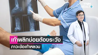 ข้อเท้าหลวมเกิดจากอะไร และมีอาการอย่างไรบ้าง