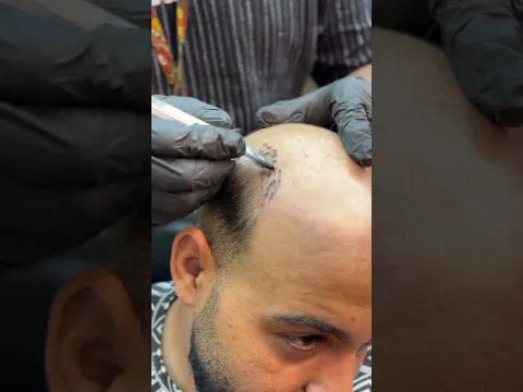 زراعه شعر ف دقيقه ✂️😂 #funny #funnyvideo #fun #new #comedy #viral #viralvideo #video #viral #video