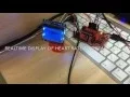 Wavelet-based Adaptive ECG Feature Extraction
