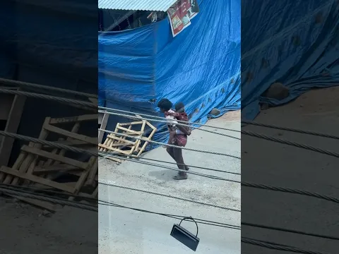 പളനി താമസിക്കാൻ പോയി രണ്ടാമത്തെ ദിവസം കണ്ണിൽ infection ആയി.😵‍💫😅#shorts