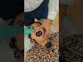 CFR For Sinusitis And Facial Pain
