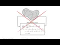 Distributed and Localized Closed Loop Model Predictive Control via System Level Synthesis