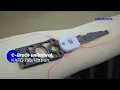 C-Brace unilateral KAFO fabrication Ottobock Professionals