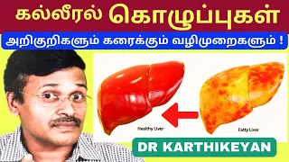  fatty liver symptoms treatment