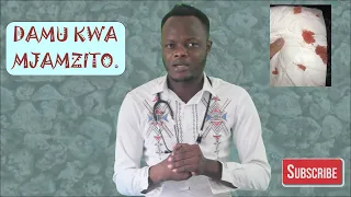 Kwanini Mama Mjamzito Hutoktwa Na Matone Ya Damu Kutokwa Damu Kwa Mama Mjamzito 
