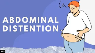 abdominal distention everything you need to know