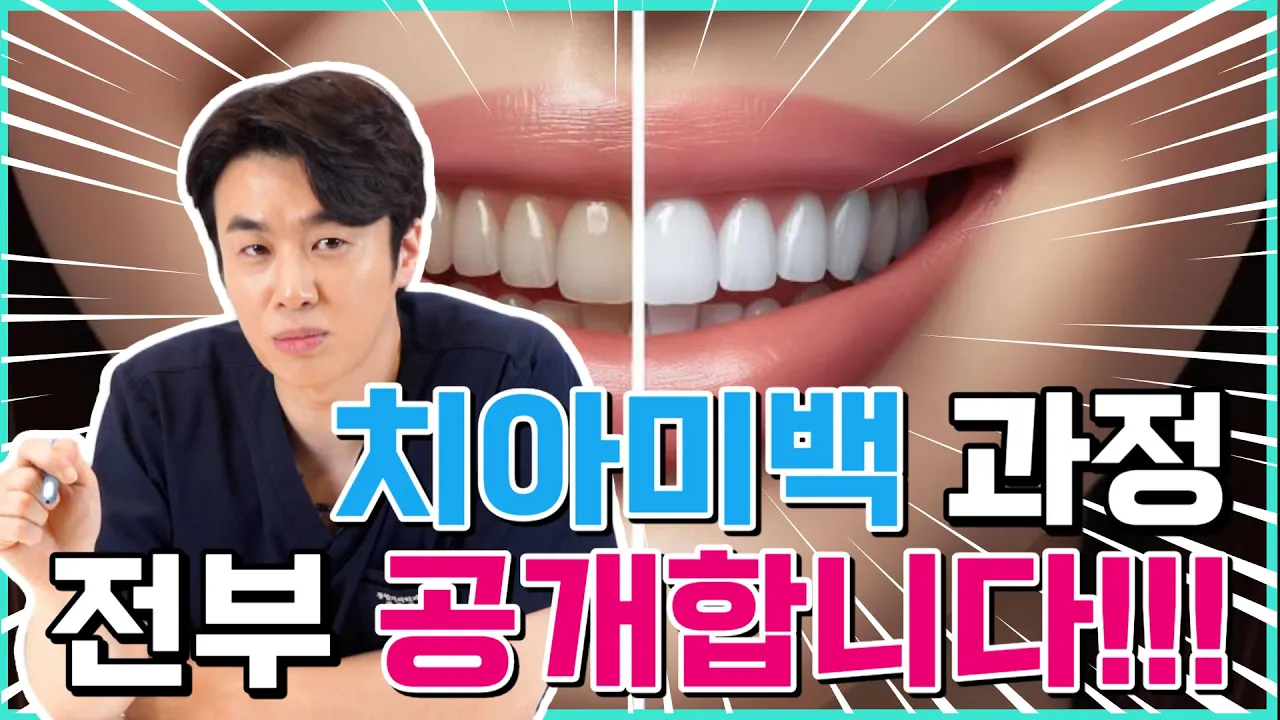 치아미백 이 영상으로 종결합니다❗❗ | 전문가 미백 시술과정, 주의사항💥