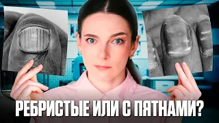 Что НА САМОМ ДЕЛЕ означают эти состояния НОГТЕЙ