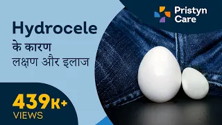 Download Hydrocele के कारण, लक्षण और इलाज | Testicle swelling MP3