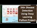 Skin Disease Detection Using Deep Learning Skin Disease Detection Using Python Opencv Code