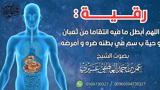 رقية اللهم أبطل ما فيه انتقاما من ثعبان و حية ب سم في بطنه ضره و أمرضه الشيخ عمر العاطفي 