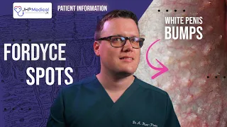 Fordyce Spots Granules Yellow or White Lumps on the Penis Doctor s Review