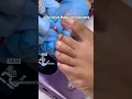 What makes the Medical pedicure so much better than a regular one