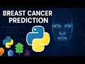 Breast Cancer Prediction using Python Machine Learning Project with Full Code EkamOfficial