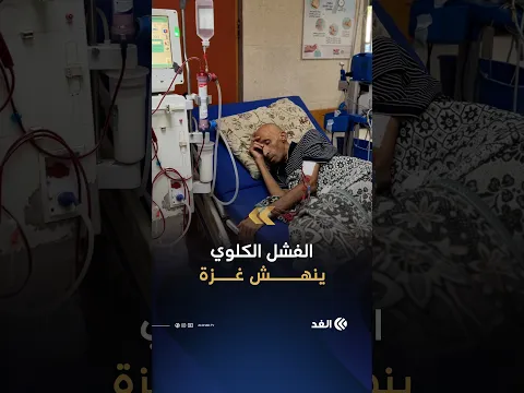 بلا أمل يلوح في الأفق.. معاناة مرضى الفشل الكلوي في قطاع غزة مستمرة