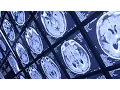 Download Lagu When memory loss is and isn't normal