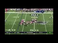Tom Brady 2008 Injury