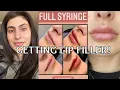 I GOT LIP FILLER Before After and Healing Process Restylane Kysse Lip Filler