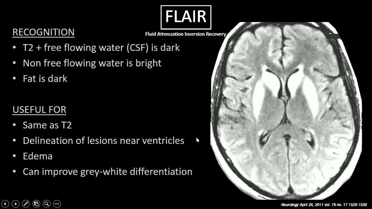 MRI Sequences